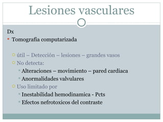 Trauma cardiaco cerrado