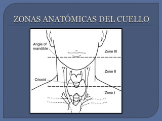 ZONAS ANATÓMICAS DEL CUELLO