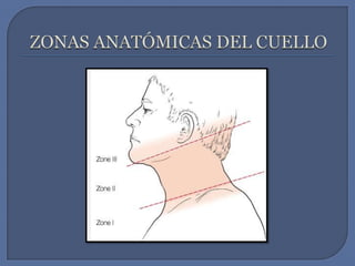 ZONAS ANATÓMICAS DEL CUELLO