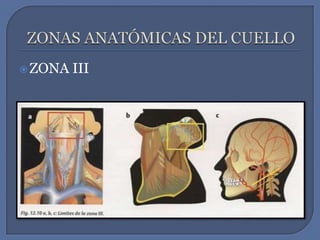ZONAS ANATÓMICAS DEL CUELLOZONA III