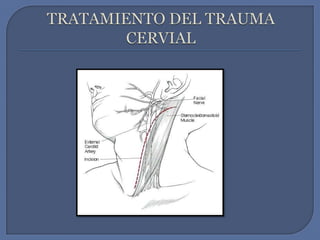 TRATAMIENTO DEL TRAUMA CERVIAL