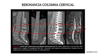 RESONANCIA COLUMNA CERVICAL
SERAM 2012
 