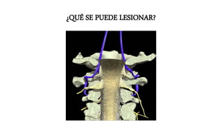 ¿QUÉ SE PUEDE LESIONAR?
 