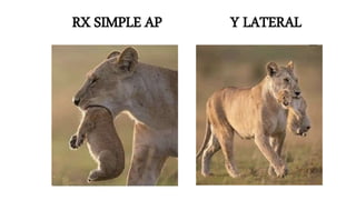 RX SIMPLE AP Y LATERAL
 