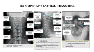 RX SIMPLE AP Y LATERAL, TRANSORAL
Apofisis
espinosa del
axis
Apófisis Odontoides
Masa lateral
del Atlas
Apófisis transversa
Art. Atlanto –
axoideaDisco
inter-
vertebral
Apófisis
Uncifor
me
Apofisis
espinosa
Apofisis
tranversa
Ángulo
Mandibular
Apofisis Mastoides
1º Costilla
Pediculo
Apófisis
Odontoides
del Axis
Arco
posterior del
Atlas
Facetas
Articulares
C6- C7
Apófisis
Espinosa
C7
Arco
anterior del
Atlas
Hiodes
Apófisis
Tranversa C5
Cuerpo Vertebral C7
Hiodes
• Desplazamiento masas laterales altas (si
> 7 mm en conjunto significa rotura
transverso)
• Fx odontoides
• Inclinacion cuerpo vertebral
• Alineación espinosos
• Espacion tedios blandos retrofaringeos
• A nivel C2 < 2mm
• A nivel C6 < 6 mm
• Alineacion CI y C2: Espacio odontoides arco anterior <
3.5 mm --- si es mayor lesion osea o ligamentaria
• La odontoides debe de ser equidistante a las masas
laterales de C1
Las masas laterales no deben sobresalir de los
márgenes laterales de C2
 