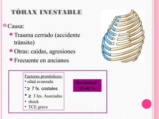 Trauma toracio cirugia | PPT