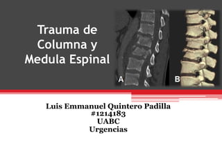 Trauma de
Columna y
Medula Espinal
Luis Emmanuel Quintero Padilla
#1214183
UABC
Urgencias
 