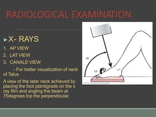 TRAUMA CON-TALAR FRACTURES.pptx