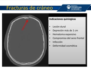 Fracturas de cráneo
Indicaciones quirúrgicas
• Lesión dural
• Depresión más de 1 cm
• Hematoma expansivo
• Compromiso del seno frontal
• Infección
• Deformidad cosmética
 