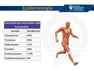 Epidemiología
 