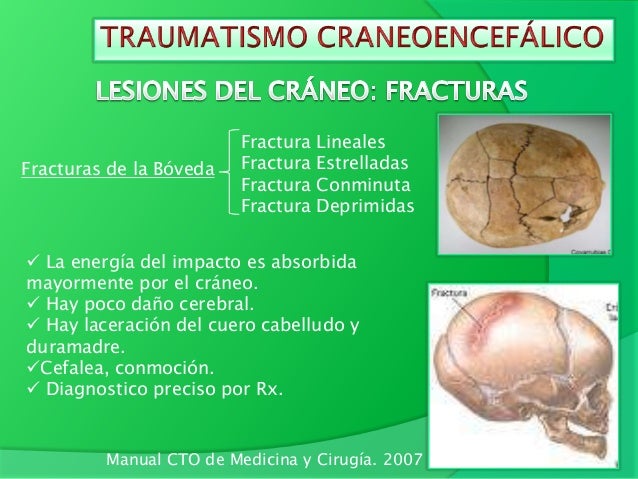 Trauma Craneoencefálico