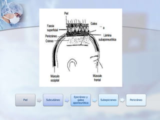 Piel Subcutáneo
Epicráneo y
galea
aponeurótica
Subepicraneo Pericráneo
 