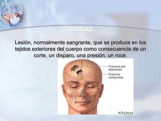 HERIDAS
Lesión, normalmente sangrante, que se produce en los
tejidos exteriores del cuerpo como consecuencia de un
corte, un disparo, una presión, un roce.
 