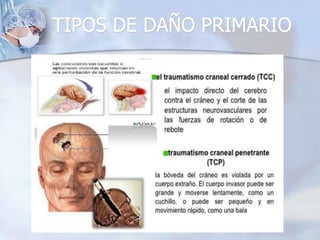 TIPOS DE DAÑO PRIMARIO
 