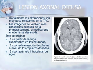LESION AXONAL DIFUSA
 Inicialmente las alteraciones son
muy poco relevantes en la TAC.
 Las imágenes se vuelven más
conspicuas después de la
primera semana, a medida que
el edema se desarrolla.
Éste se origina:
 1) a partir de la fuga
axoplásmica en las neuronas,
 2) por extravasación de plasma
a nivel de los capilares dañados,
 3) por acúmulo intracelular de
agua.
 