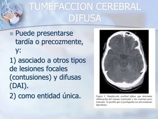 TUMEFACCION CEREBRAL
DIFUSA
 Puede presentarse
tardía o precozmente,
y:
1) asociado a otros tipos
de lesiones focales
(contusiones) y difusas
(DAI).
2) como entidad única.
 