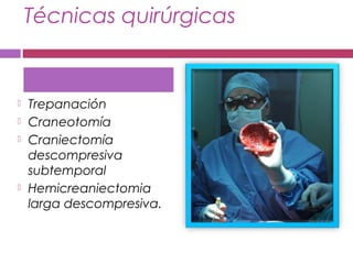 Técnicas quirúrgicas
 Trepanación
 Craneotomía
 Craniectomía
descompresiva
subtemporal
 Hemicreaniectomia
larga descompresiva.
 