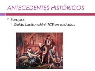 ANTECEDENTES HISTÓRICOS
 Europa:
 Guido Lanfranchini- TCE en soldados
 