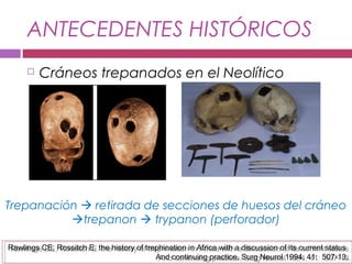 ANTECEDENTES HISTÓRICOS
 Cráneos trepanados en el Neolítico
Rawlings CE, Rossitch E. the history of trephination in Africa with a discussion of its current status
And continuing practice. Surg Neurol 1994, 41: 507-13.
Rawlings CE, Rossitch E. the history of trephination in Africa with a discussion of its current status
And continuing practice. Surg Neurol 1994, 41: 507-13.
Trepanación  retirada de secciones de huesos del cráneo
trepanon  trypanon (perforador)
 