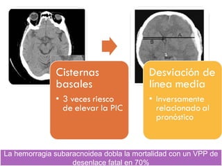 La hemorragia subaracnoidea dobla la mortalidad con un VPP de
desenlace fatal en 70%
La hemorragia subaracnoidea dobla la mortalidad con un VPP de
desenlace fatal en 70%
 
