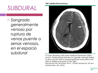 SUBDURAL
 Sangrado
generalmente
venoso por
ruptura de
venas puente o
senos venosos,
en el espacio
subdural
 