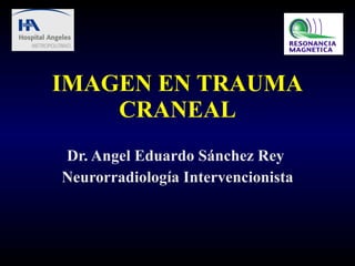IMAGEN EN TRAUMA CRANEAL Dr. Angel Eduardo Sánchez Rey  Neurorradiología Intervencionista 