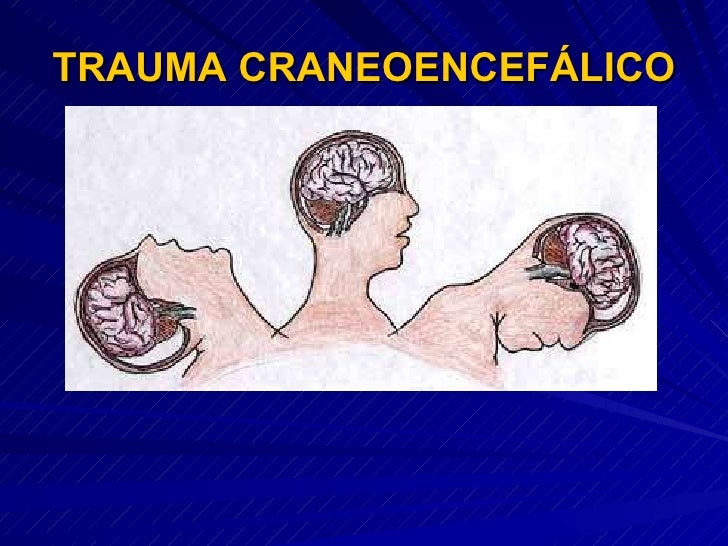 Trauma craneoencefálico(b) virtual Trauma craneoencefálico(b) virtual