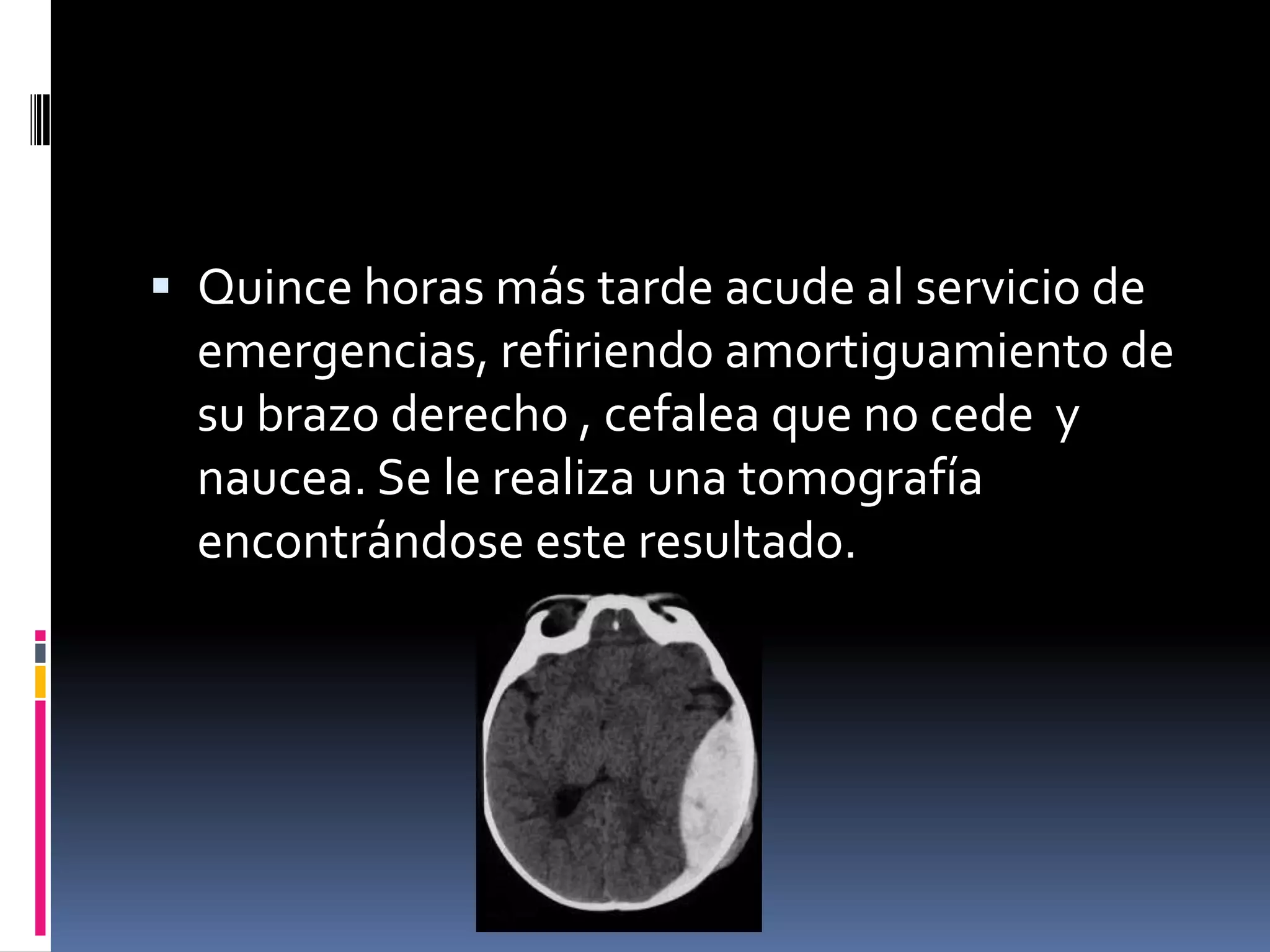  Quince horas más tarde acude al servicio de
  emergencias, refiriendo amortiguamiento de
  su brazo derecho , cefalea que no cede y
  naucea. Se le realiza una tomografía
  encontrándose este resultado.
 