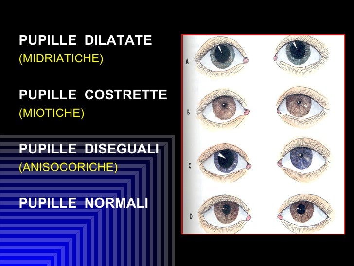 Trauma cranico toracico addominale