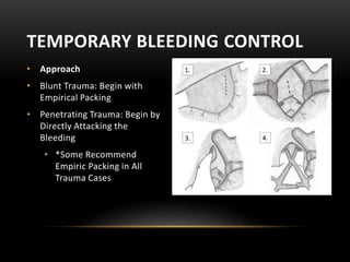 • Approach
• Blunt Trauma: Begin with
Empirical Packing
• Penetrating Trauma: Begin by
Directly Attacking the
Bleeding
• *Some Recommend
Empiric Packing in All
Trauma Cases
TEMPORARY BLEEDING CONTROL
 