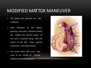 MODIFIED MATTOX MANEUVER
 The spleen and pancreas are also
mobilized.
 With reflection of the spleen,
pancreas, and colon anteriorly toward
the midline, the anterior aspect of
the aorta is exposed along with the
origins of the left renal, superior
mesenteric, and celiac arteries.
 The aortic hiatus (left crus) may
need to be incised to provide
additional cephalad exposure
 