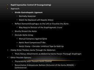 • Rapid Supraceliac Control (If Exsanguinating)
• Approach:
• Divide Gastrohepatic Ligament
• Normally Avascular
• Watch for Replaced Left Hepatic Artery
• Reflect Stomach/Esophagus to the Left to Visualize the Aorta
• May Require Division of the Diaphragmatic Crura
• Bluntly Dissect the Aorta
• Occlude Aorta Using:
• Manual Compress Against Spine
• Aortic Root Compressor/T-Bar
• Aortic Clamp – Consider Umbilical Tape to Hold Up
• Clamp Distal Thoracic Aorta Through the Abdomen
• Thick Fibrous Attachments as Abdominal Aorta Passes Thorough Diaphragm
• Other Possible Options:
• Thoracotomy with Thoracic Aortic Control
• Resuscitative Endovascular Balloon Occlusion of the Aorta (REBOA) –
Controversial
 