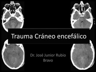 Trauma Cráneo encefálico
Dr. José Junior Rubio
Bravo
 
