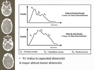 • P2: Indica la capacidad distención
A mayor altitud menor distención
Volumen
Volumen
 