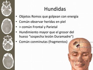 Hundidas
• Objetos Romos que golpean con energía
• Común observar heridas en piel
• > común Frontal y Parietal
• Hundimiento mayor que el grosor del
hueso “sospecha lesión Duramadre”)
• Común conminutas (fragmentos)
 