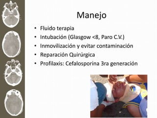 Manejo
• Fluido terapia
• Intubación (Glasgow <8, Paro C.V.)
• Inmovilización y evitar contaminación
• Reparación Quirúrgica
• Profilaxis: Cefalosporina 3ra generación
 