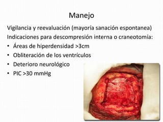 Manejo
Vigilancia y reevaluación (mayoría sanación espontanea)
Indicaciones para descompresión interna o craneotomía:
• Áreas de hiperdensidad >3cm
• Obliteración de los ventrículos
• Deterioro neurológico
• PIC >30 mmHg
 