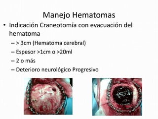 Manejo Hematomas
• Indicación Craneotomía con evacuación del
hematoma
– > 3cm (Hematoma cerebral)
– Espesor >1cm o >20ml
– 2 o más
– Deterioro neurológico Progresivo
 