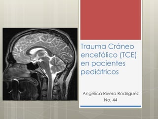 Trauma Cráneo
encefálico (TCE)
en pacientes
pediátricos

Angélica Rivera Rodríguez
         No. 44
 