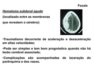 Focais
Hematoma subdural agudo
(localizado entre as membranas
que revestem o cérebro):




•Traumatismo decorrente de aceleração e desaceleração
em altas velocidades;
•Pode ser simples e tem bom prognóstico quando não há
lesão cerebral associada;
•Complicações são acompanhadas      de   laceração   do
parênquima e dos vasos.
 