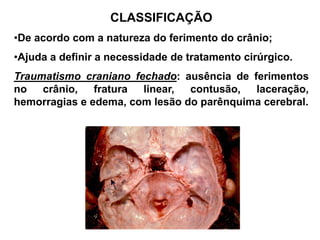 CLASSIFICAÇÃO
•De acordo com a natureza do ferimento do crânio;
•Ajuda a definir a necessidade de tratamento cirúrgico.
Traumatismo craniano fechado: ausência de ferimentos
no   crânio, fratura   linear, contusão, laceração,
hemorragias e edema, com lesão do parênquima cerebral.
 