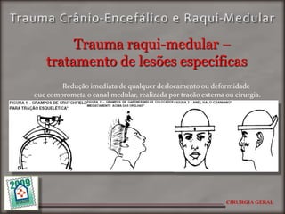 Trauma raqui-medular –
   tratamento de lesões específicas
        Redução imediata de qualquer deslocamento ou deformidade
que comprometa o canal medular, realizada por tração externa ou cirurgia.




                                                             CIRURGIA GERAL
 