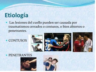Trauma cuello 
