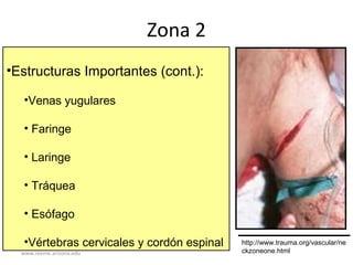 www.reeme.arizona.edu
Zona 2
•Estructuras Importantes (cont.):
•Venas yugulares
• Faringe
• Laringe
• Tráquea
• Esófago
•Vértebras cervicales y cordón espinal http://www.trauma.org/vascular/ne
ckzoneone.html
 