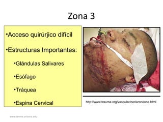 www.reeme.arizona.edu
Zona 3
•Acceso quirúrjico difícil
•Estructuras Importantes:
•Glándulas Salivares
•Esófago
•Tráquea
•Espina Cervical http://www.trauma.org/vascular/neckzoneone.html
 