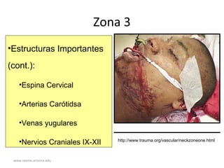 www.reeme.arizona.edu
Zona 3
•Estructuras Importantes
(cont.):
•Espina Cervical
•Arterias Carótidsa
•Venas yugulares
•Nervios Craniales IX-XII http://www.trauma.org/vascular/neckzoneone.html
 