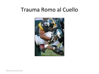 www.reeme.arizona.edu
Trauma Romo al Cuello
 
