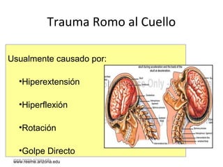 www.reeme.arizona.edu
Trauma Romo al Cuello
Usualmente causado por:
•Hiperextensión
•Hiperflexión
•Rotación
•Golpe Directo
www.reeme.arizona.edu
 