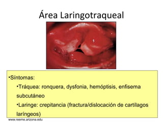 www.reeme.arizona.edu
Área Laringotraqueal
•Síntomas:
•Tráquea: ronquera, dysfonia, hemóptisis, enfisema
subcutáneo
•Laringe: crepitancia (fractura/dislocación de cartílagos
laríngeos)
www.reeme.arizona.edu
 