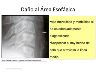 www.reeme.arizona.edu
Daño al Área Esofágica
http://www.trauma.org/vascular/neckoeso.html
•Alta mortalidad y morbilidad si
no es adecuadamente
diagnosticado
•Sospechar si hay herida de
bala que atraviesa la línea
media
 